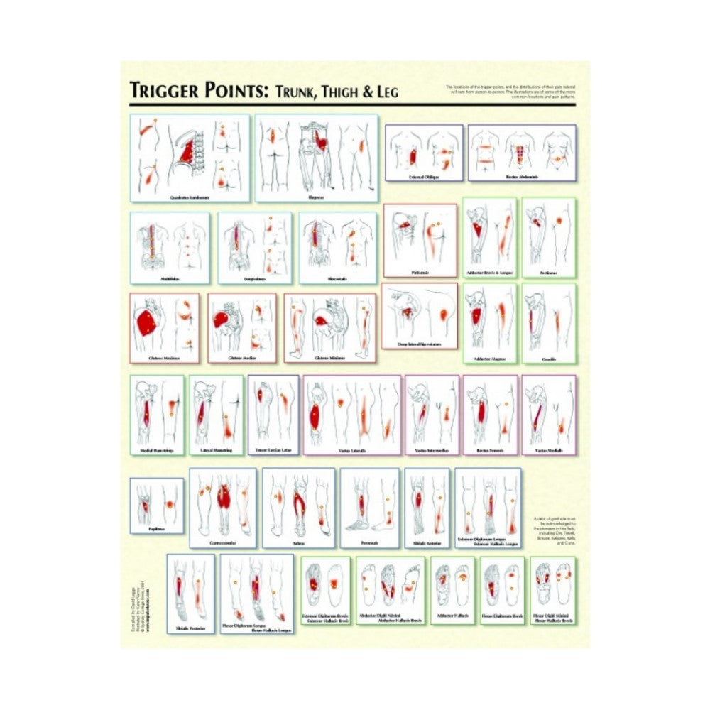 Charte "Trigger Points" par Legge (2)