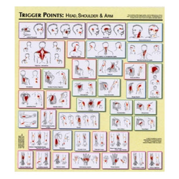 Charte "Trigger Points" par Legge (2)